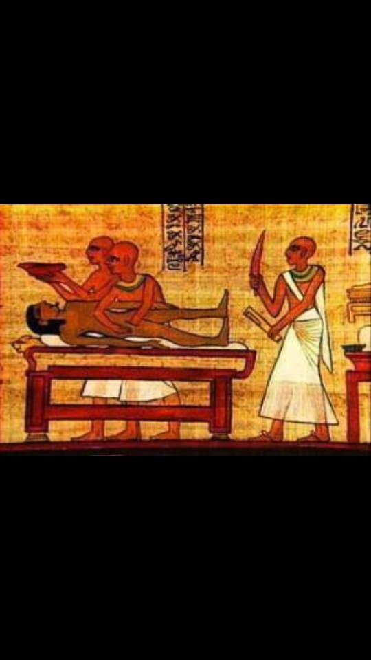 براعة القدماء المصريين فى الطب