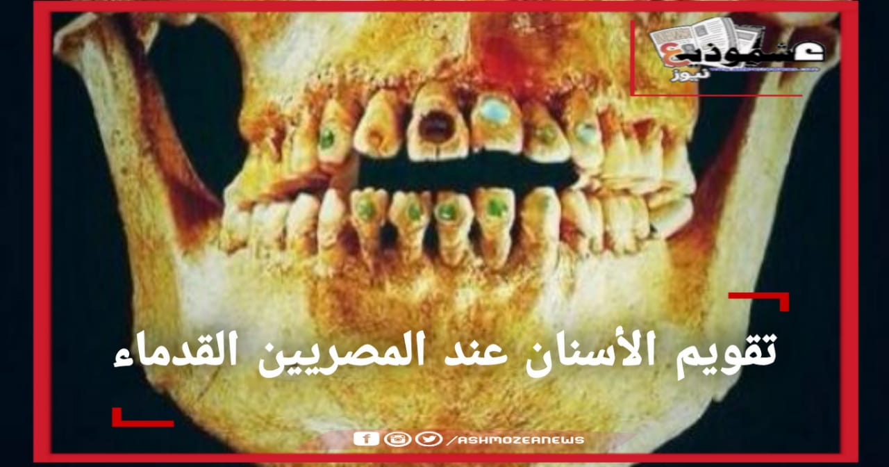 تقويم الأسنان عند المصريين القدماء