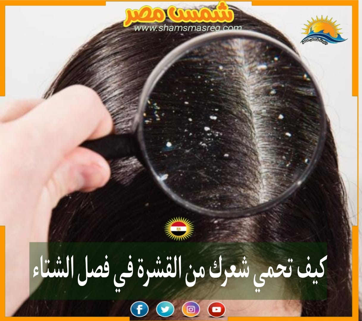 |شمس مصر|.. كيف تحمي شعرك من القشرة في فصل الشتاء.