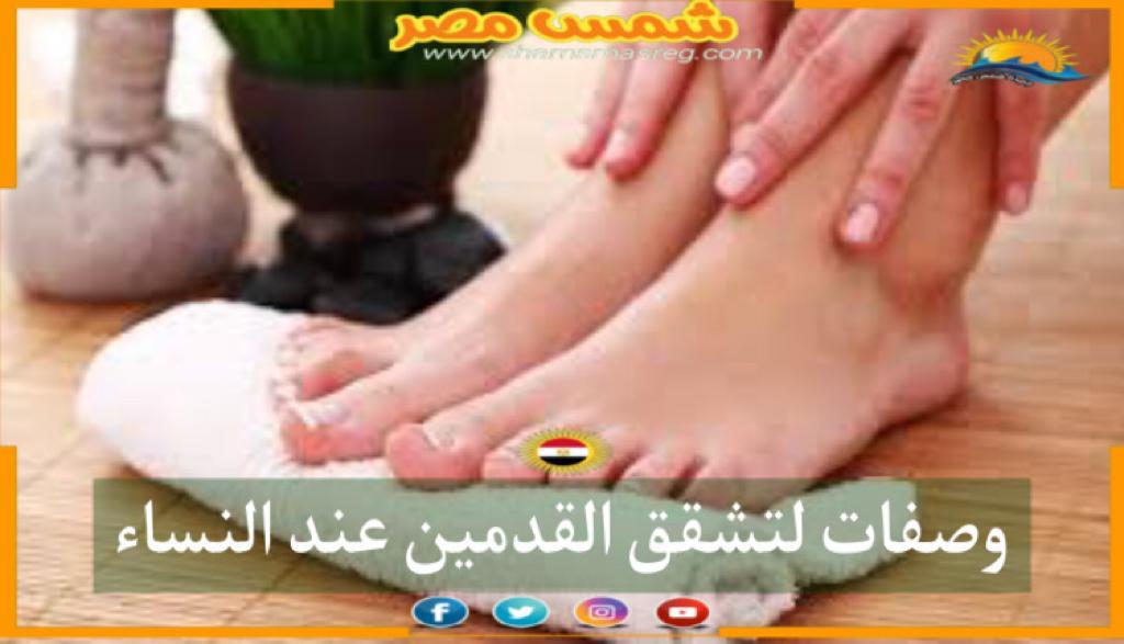 |شمس مصر|.. وصفات لتشقق القدمين عند النساء