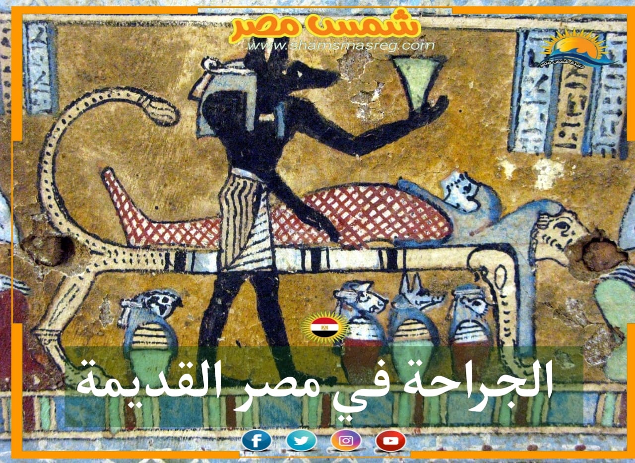 شمس مصر/الجراحة في مصر القديمة.